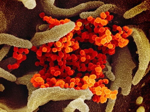 Так выглядит коронавирус под электронным микроскопом
