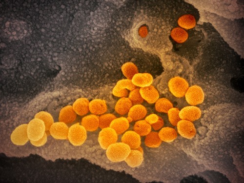 Так выглядит коронавирус под электронным микроскопом