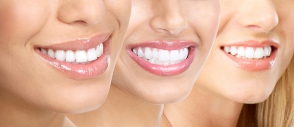 С белоснежной улыбкой к успеху… или отбеливание зубов для девушек!