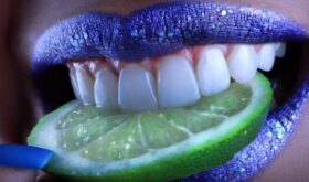 Новые зубы за 5 дней: мифы и правда об имплантации