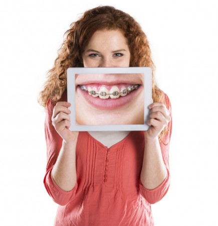Ортодонтия — с чем ее едят?