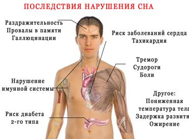 Бессонница: причины и методы лечения