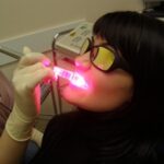 Как добиться наилучшего результата при лазерном отбеливании зубов без пагубных последствий