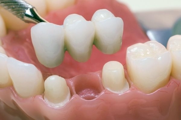 Какими возможностями обладает современная стоматология?