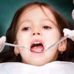Серебрение зубов детям: достоинства и недостатки этого метода