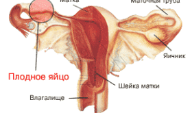 Внематочная беременность