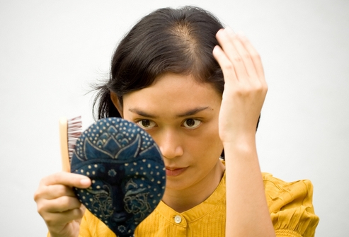 Выпадение волос и алопеция