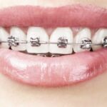 Стоматология. Признаки необходимости косметической стоматологии