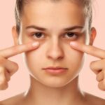 Темные круги под глазами: 7 домашних способов быстро их убрать