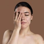 Начистоту: 6 причин, почему не проходит акне