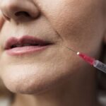 Носогубки и борозды на лбу: когда ботокс будет только во вред