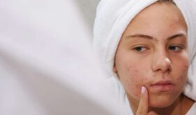 Минимум банок, максимум эффекта: базовый уход за кожей для подростков