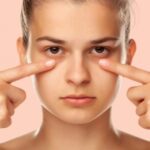 Эффект панды: как избавиться от темных кругов под глазами, 5 рабочих методов