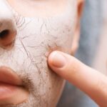 В сухом остатке: как справиться с шелушением