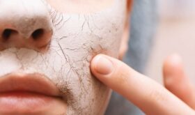 В сухом остатке: как справиться с шелушением